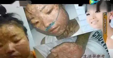 「方式」孩子就没了…这种退烧方式，千万别碰！不到3分钟