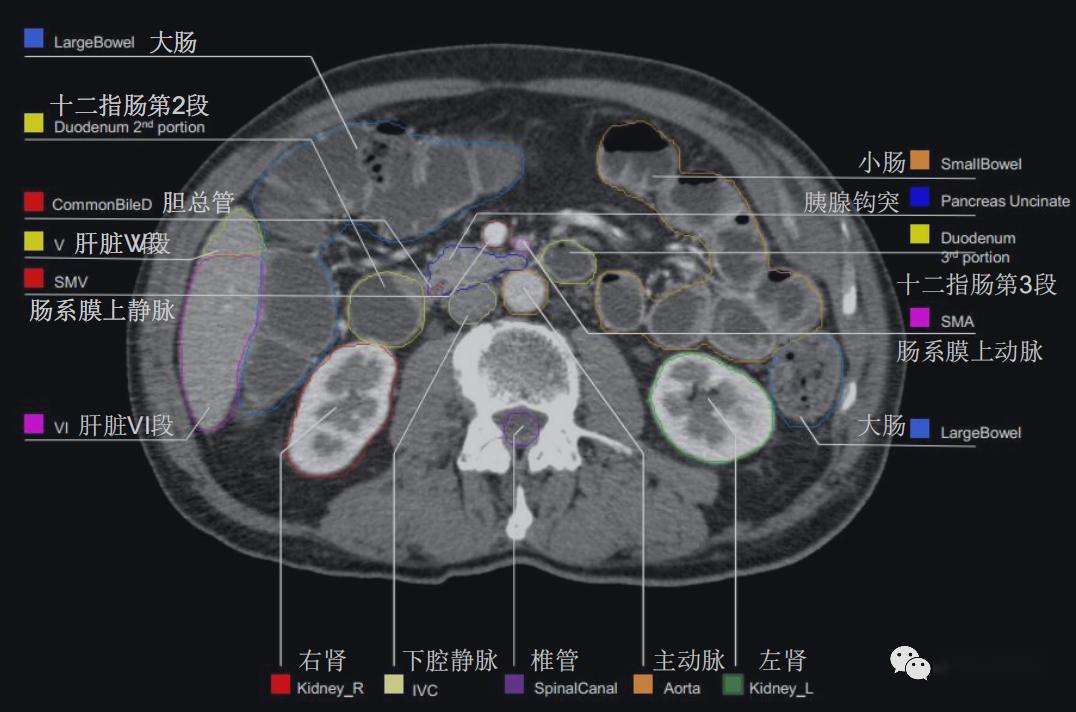 史上最详上腹部ct影像解读收藏