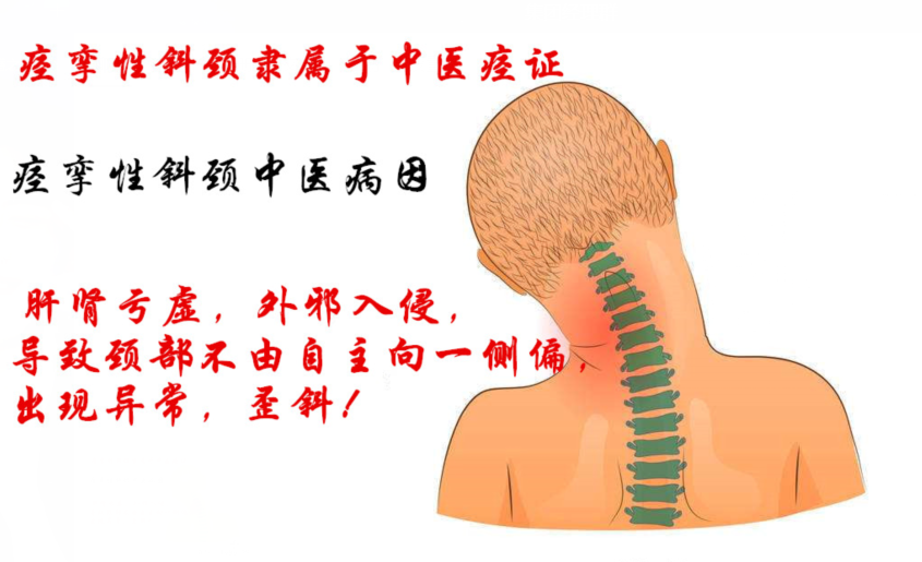 痉挛性斜颈的治疗原理_有病早治花的是小钱,有病拖着不治害的是身体,拖得严重了再治花的是(2)