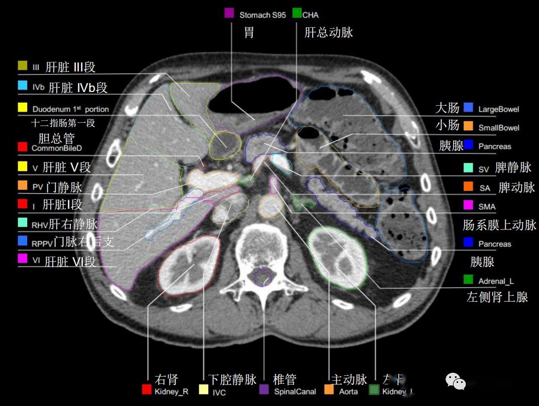 史上最详上腹部ct影像解读【收藏】