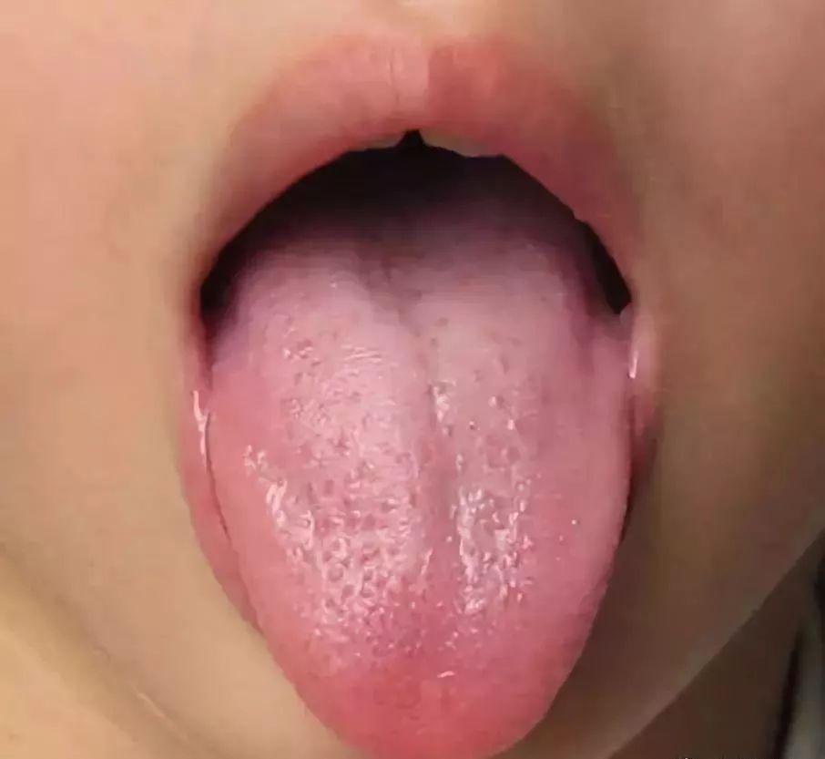 『发出的』宝宝发出的积食信号你能看懂多少?过度喂养危害大