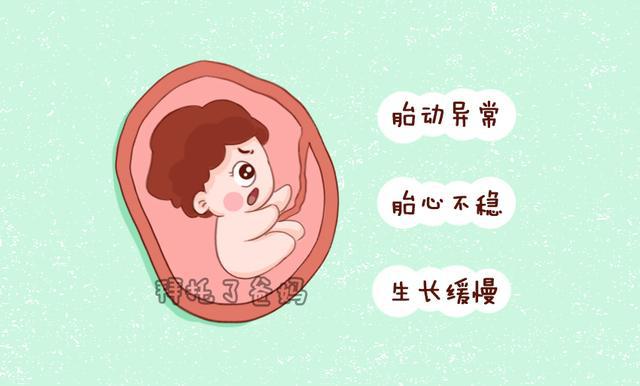 胎儿缺氧的3种表现,你发现没?孕期如何预防胎儿缺氧?