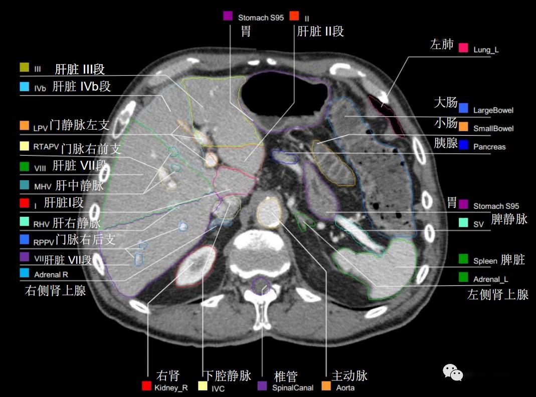 史上最详上腹部ct影像解读【收藏】