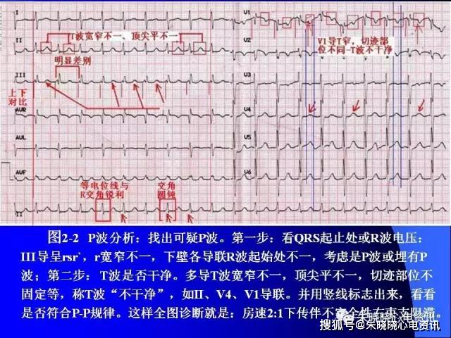 87d366d9d1ef4f4084427a865621a6bf.JPG