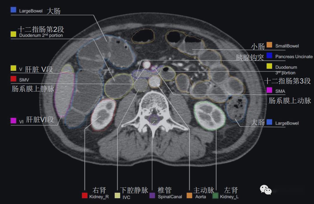 史上最详上腹部ct影像解读【收藏】