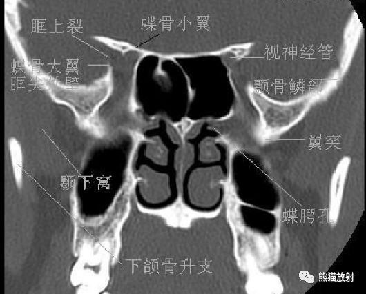 解剖头颈丨鼻,鼻腔,鼻窦