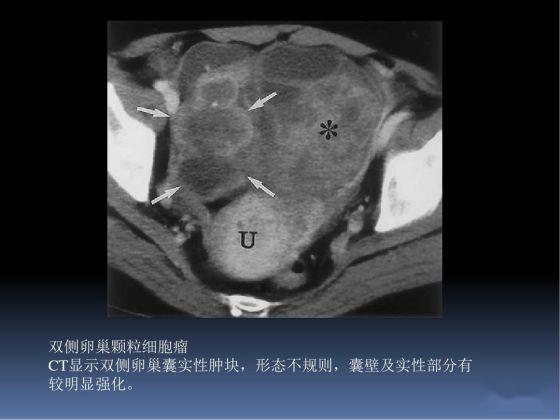 怎样能快速的找到牛的子宫颈 966756ecf7dd44d8aa18914354877ad5.jpeg