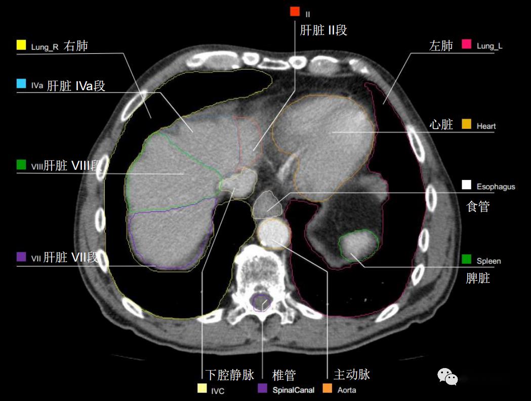 史上最详上腹部ct影像解读【收藏】