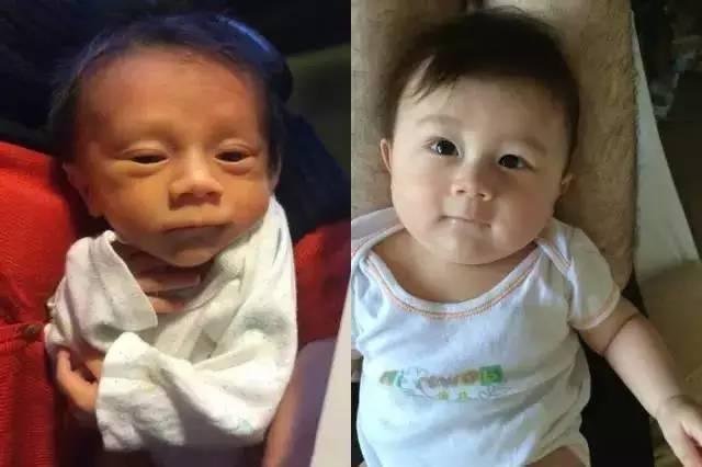 「宝宝」长开后的样子闪瞎你的眼,不信来看对比图别嫌弃刚出生的宝宝丑