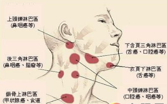 颈部淋巴结肿大如何处理