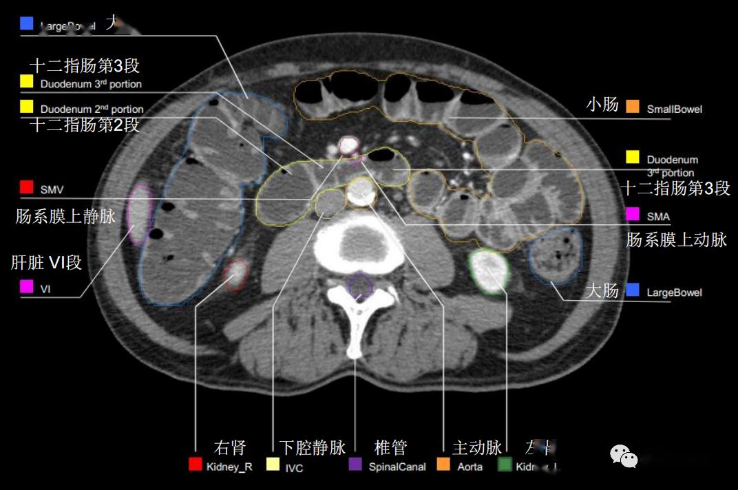 史上最详上腹部ct影像解读收藏