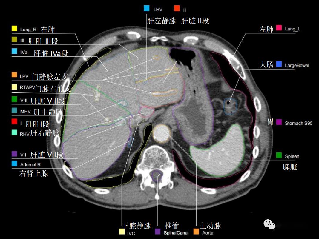 史上最详上腹部ct影像解读【收藏】