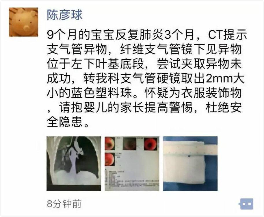 #孩子#一件衣服致孩子反复哮喘3个月！这6种衣服赶紧扔掉
