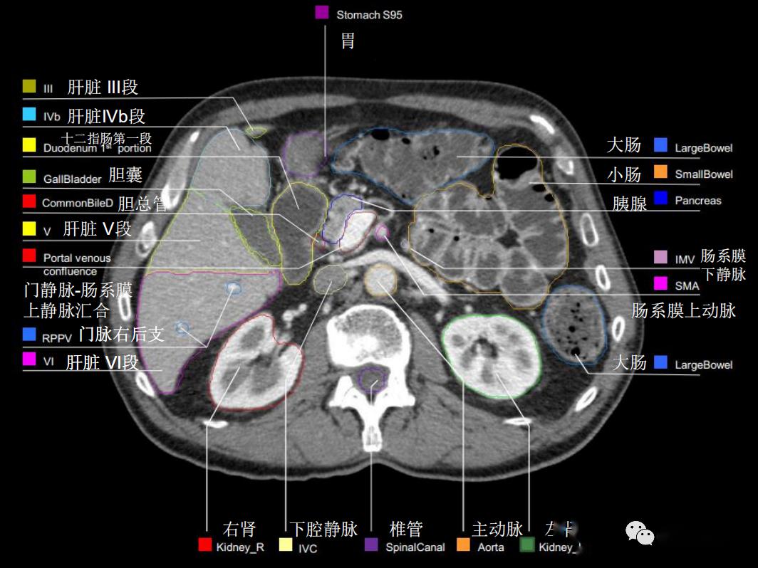 史上最详上腹部ct影像解读【收藏】