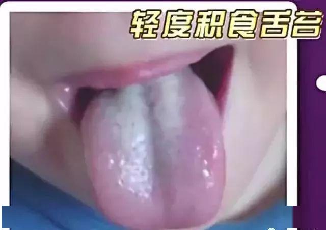 『发出的』宝宝发出的积食信号你能看懂多少?过度喂养危害大