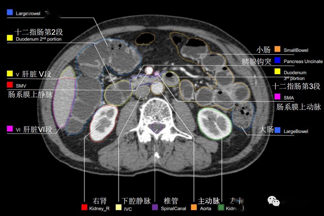 史上最详上腹部ct影像解读【收藏】