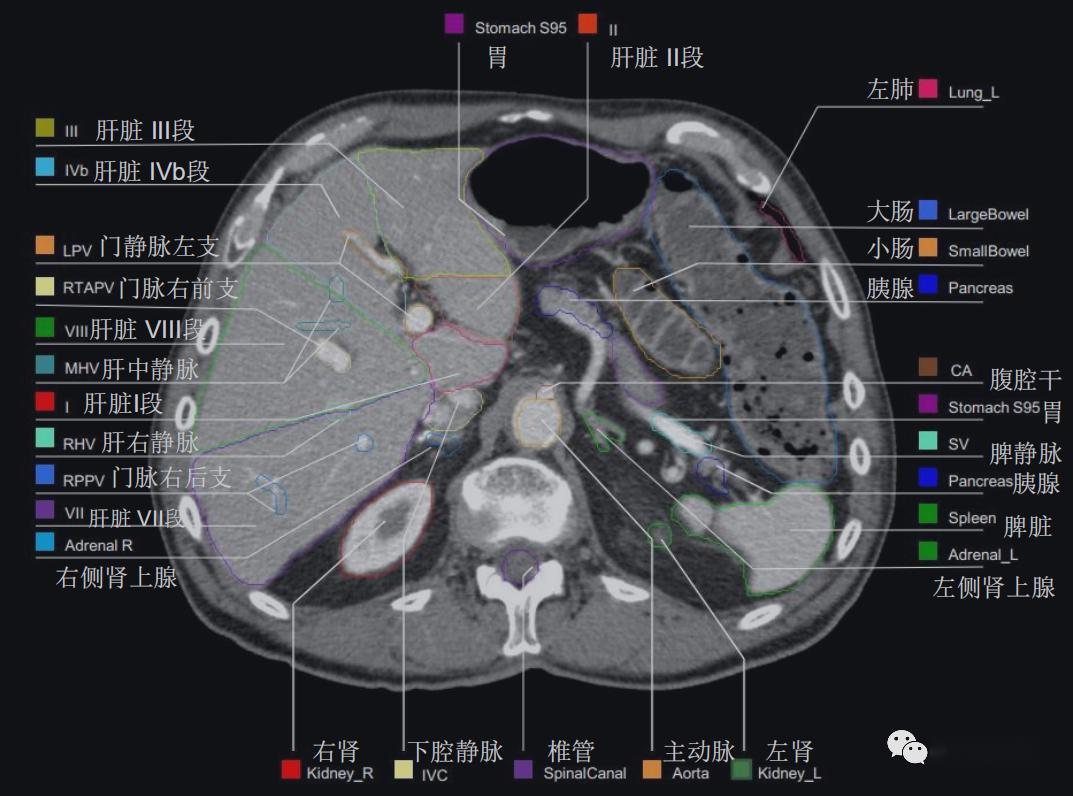 史上最详上腹部ct影像解读【收藏】