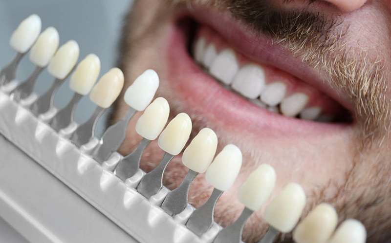 牙齿什么颜色最健康?