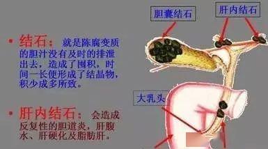 人体脏腑排毒过程