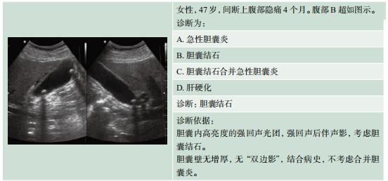 百通技能 | 影像诊断 第四节 超声诊断_胆囊