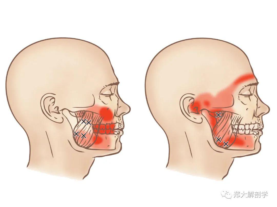 眉毛疼怎么办