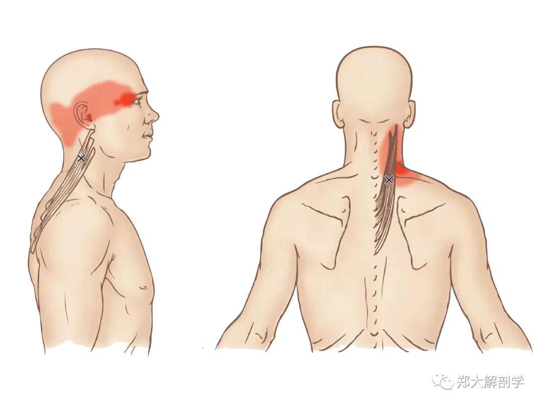 眉毛疼怎么办