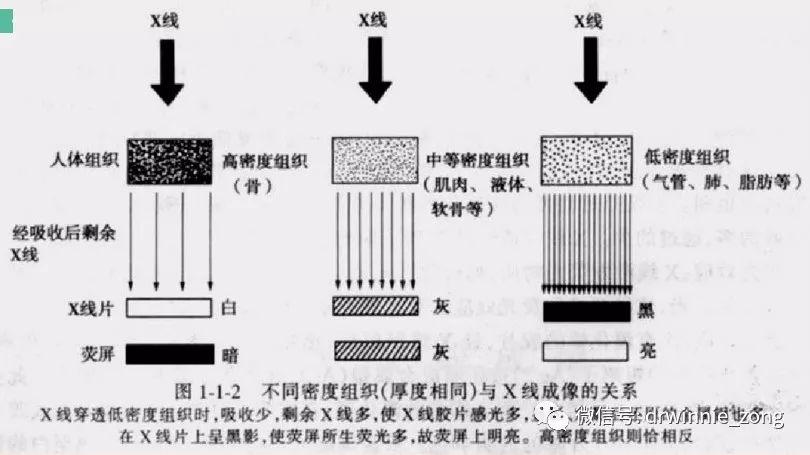 x线成像的基本原理_第一节 X线成像的基本原理与设备