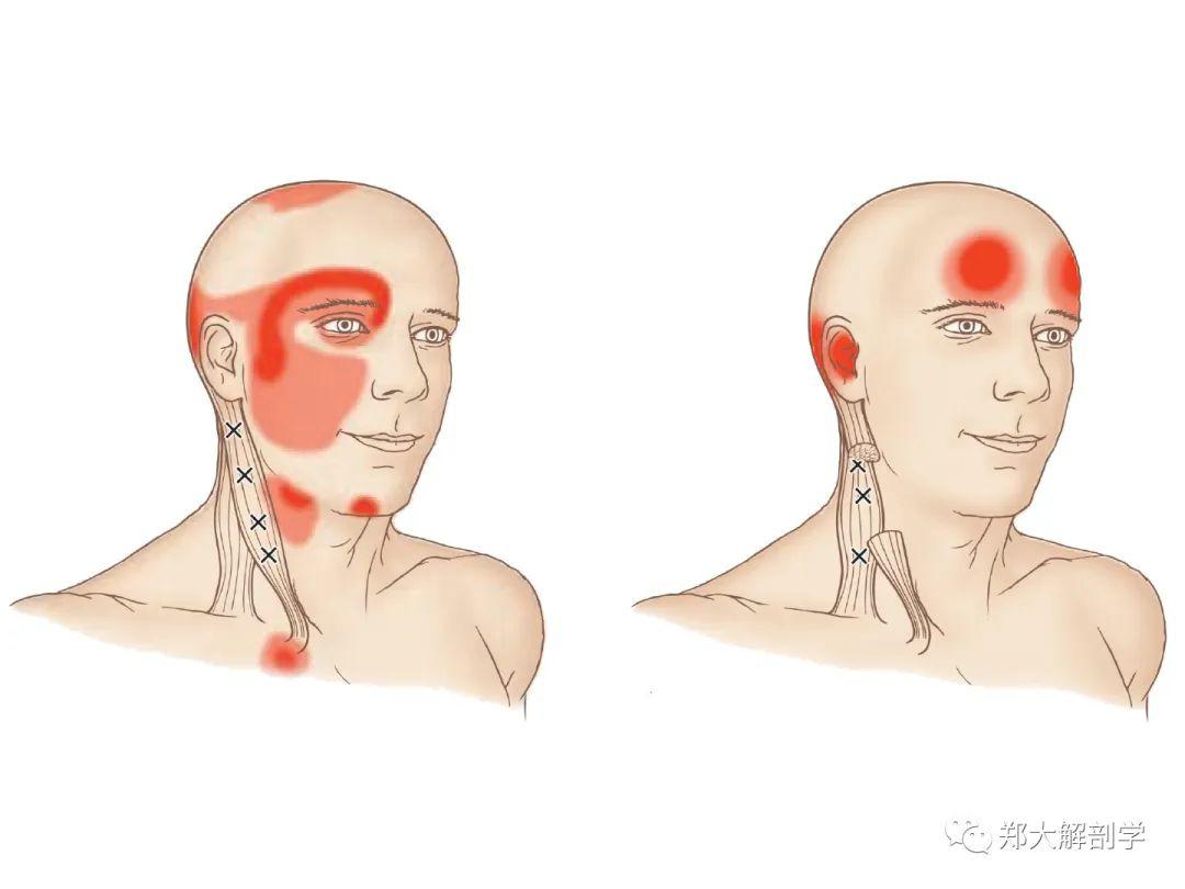 眉毛疼怎么办