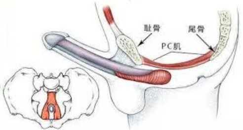 pc肌锻炼害死我了,比原来还差劲了