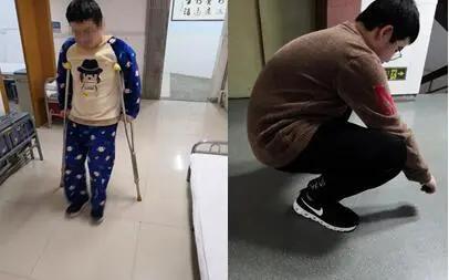 警惕青少年腰痛写在世界强制性脊柱炎日