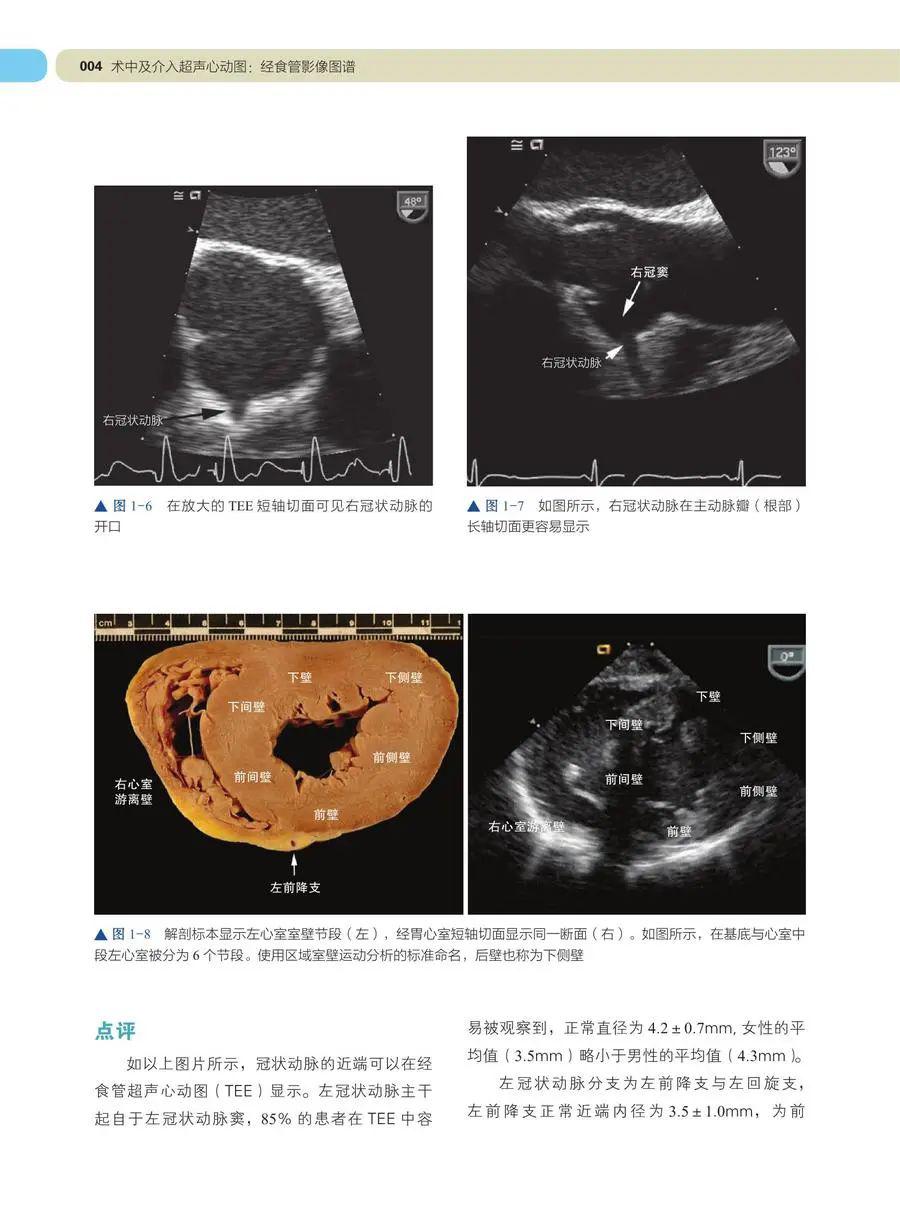 学习tee必备 | 术中及介入超声心动图:经食管影像图谱