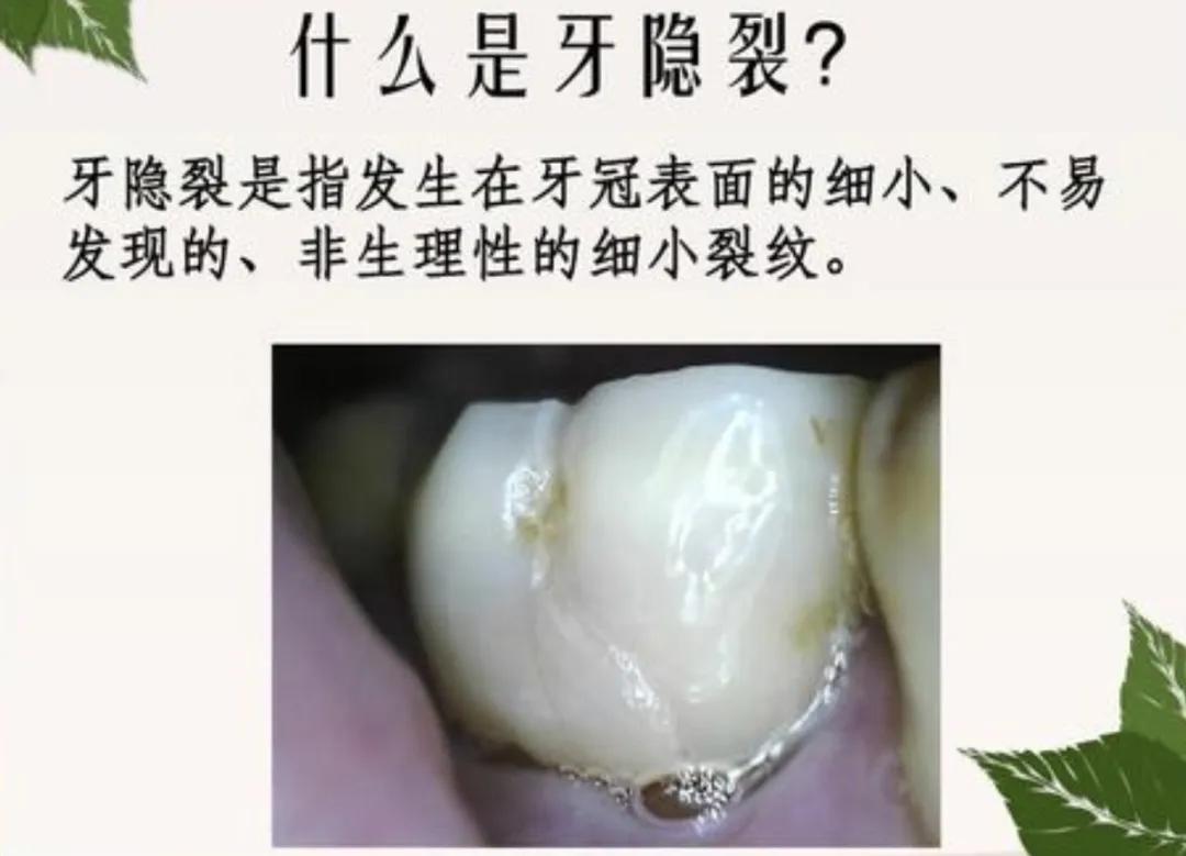 牙痛有不同痛感看你是哪种疼痛感高新华怡口腔