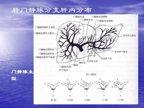 门静脉栓子分血栓,瘤栓和炎栓