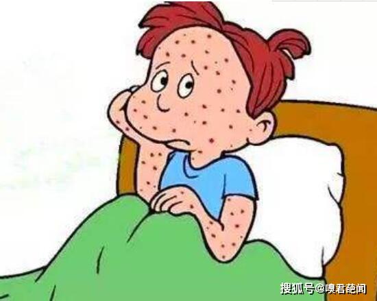 出水痘要注意什么,禁用手抓/隔离小孩/涂药膏止痒(保持干净)
