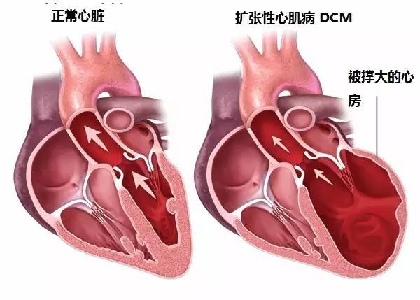 狗狗心脏疾病太突然，心脏肥大不好医治，该怎么办？铲屎官要注意什么？