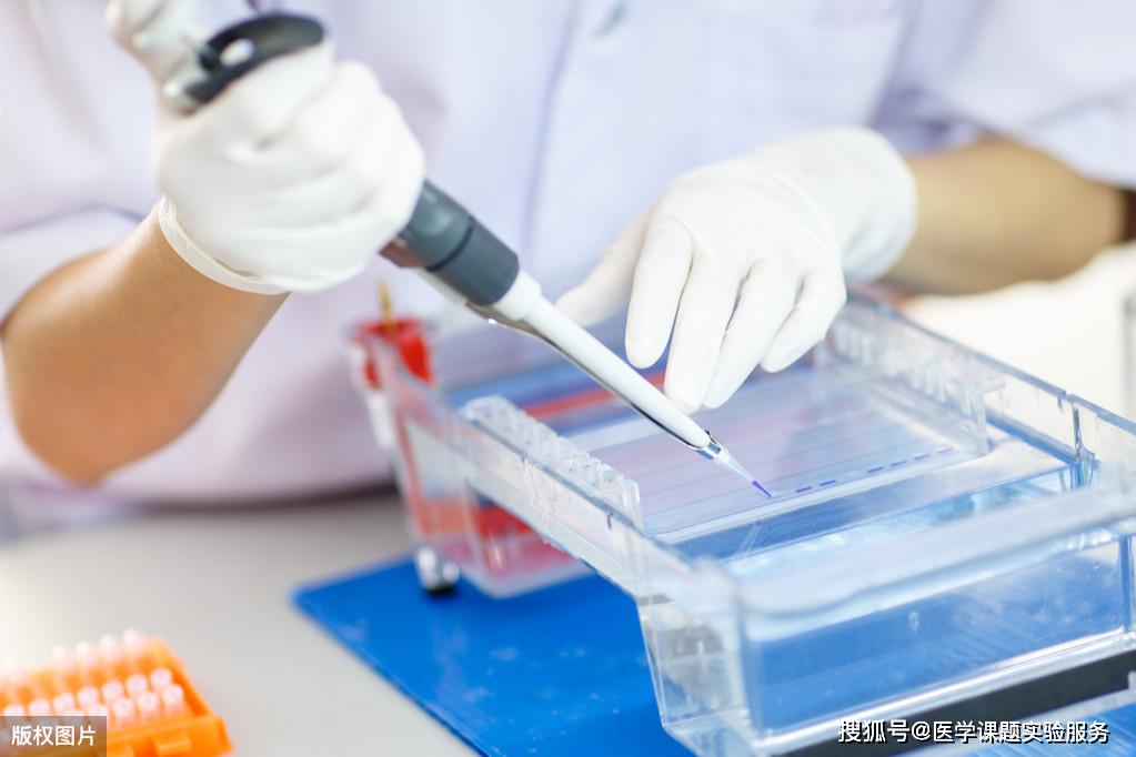 6个问题带你认识什么是凝胶迁移实验emsa