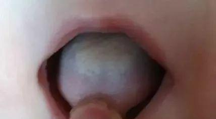 [孩子]孩子积食、难受、吃饭差？告诉你几个不用吃药的小妙招