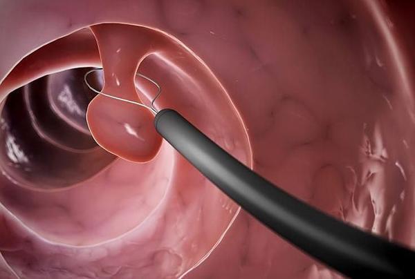 怎么样减少胃酸分泌 dfdd63d715c042049348e7f59376ecdd.jpeg