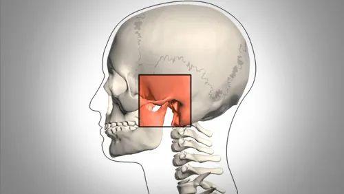 打哈欠吃东西"咔咔"响 这可能是颞下颌关节紊乱