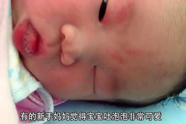 「宝宝」如有这2种情况，不能再忽视宝宝嘴里总是吐泡泡？4个原因要知道