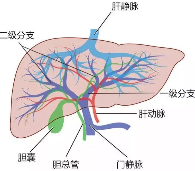 可怕的门静脉癌栓它是肝癌患者的鬼门关