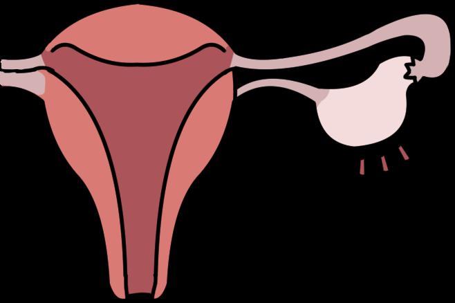 检查子宫形态及卵巢情况