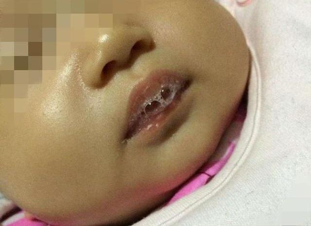 「宝宝」如有这2种情况，不能再忽视宝宝嘴里总是吐泡泡？4个原因要知道