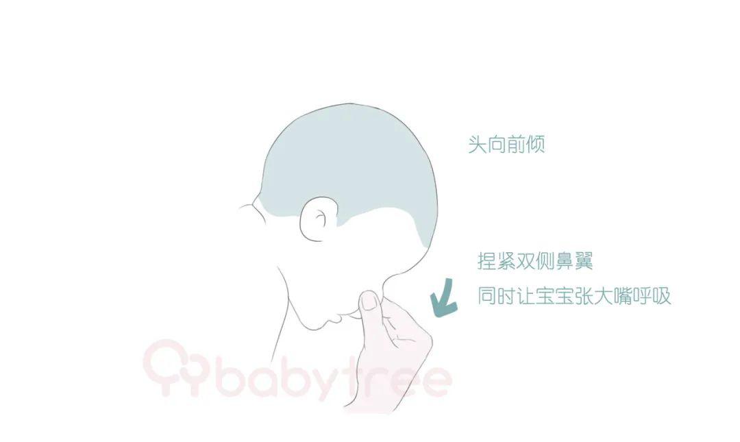 宝宝■否则孩子一辈子塌鼻子！宝宝鼻子受伤了怎么办？这几件事千万别做