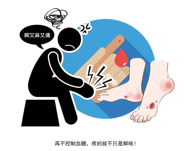 原创血糖高,腿先知!若腿部出现这3种现象,暗示糖尿病已经到来? 原创血糖高,腿先知!若腿部出现这3种现象,暗示糖尿病已经到来?