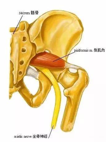 【收藏】梨状肌综合征的诊断与运动康复整体治疗(附:视频)