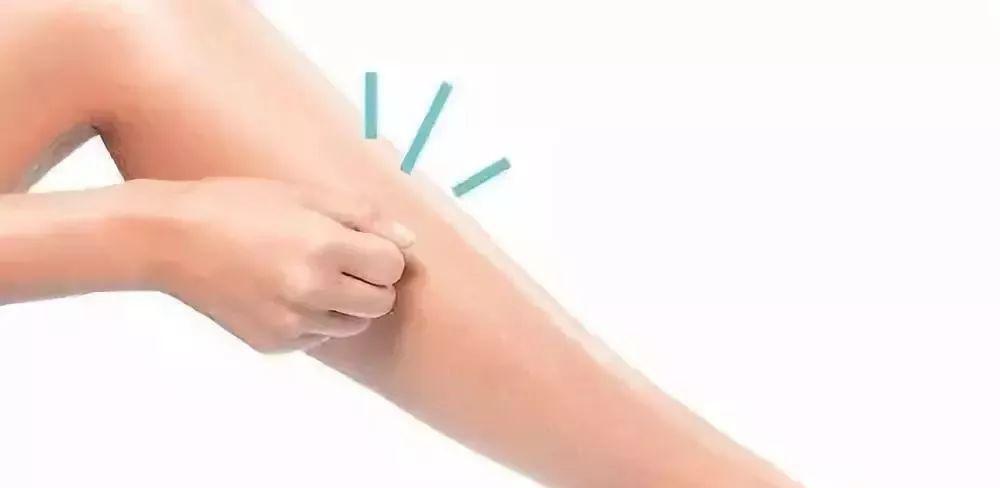 是什么原因引起的腿脚麻木 a173acdf4c8c4805b83f284b6122970b.jpeg