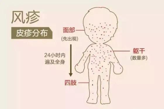 【人和宣传】春夏季传染病预防致家长一封信