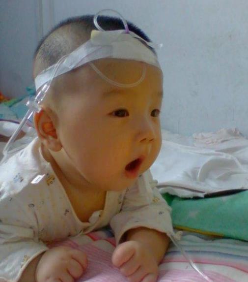 婴儿怎么查缺不缺锌 3bc482b1d9a64d7e80f4c1da48ecfe69.jpeg