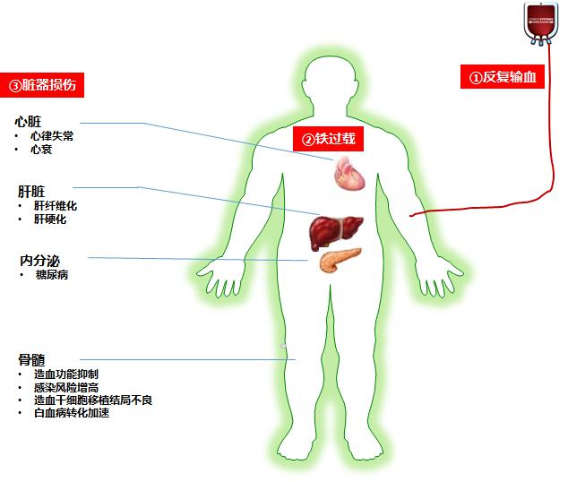 过载人口_热过载继电器接线图(2)